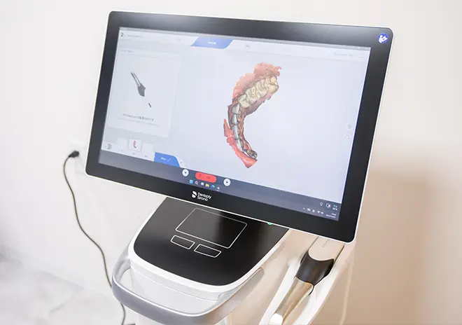 3Dデジタルスキャナー