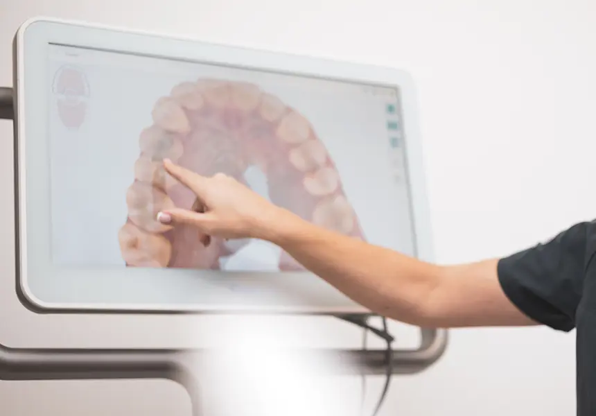 歯の移動シミュレーション