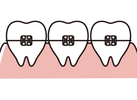 無料矯正相談会のご案内
